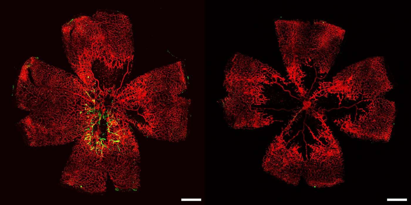 Blind People Offered Hope of Seeing Again After Stem Cell Breakthrough Remakes Retinal Blood Vessels